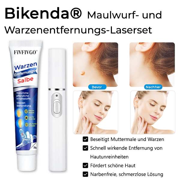 Bikenda® Maulwurf- und Warzenentfernungs-Laserset