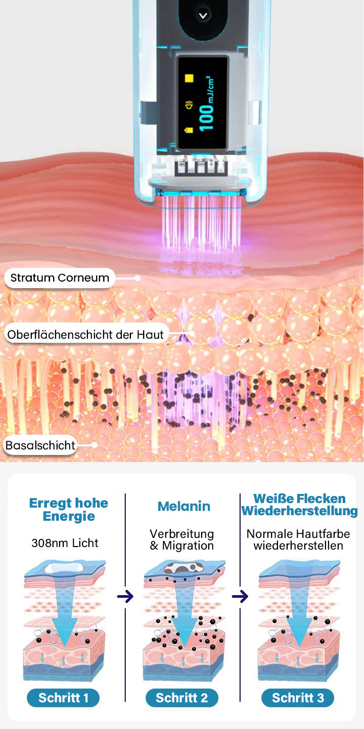 Bikenda® EVENA Vitiligo Lichttherapie Gerät