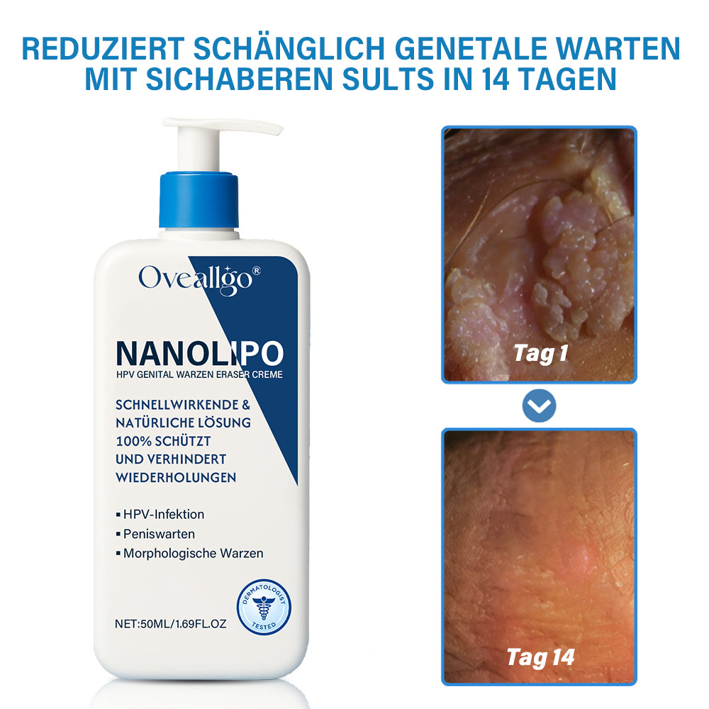 Oveallgo® NanoLipo HPV Genital warzen-Eraser creme Promax