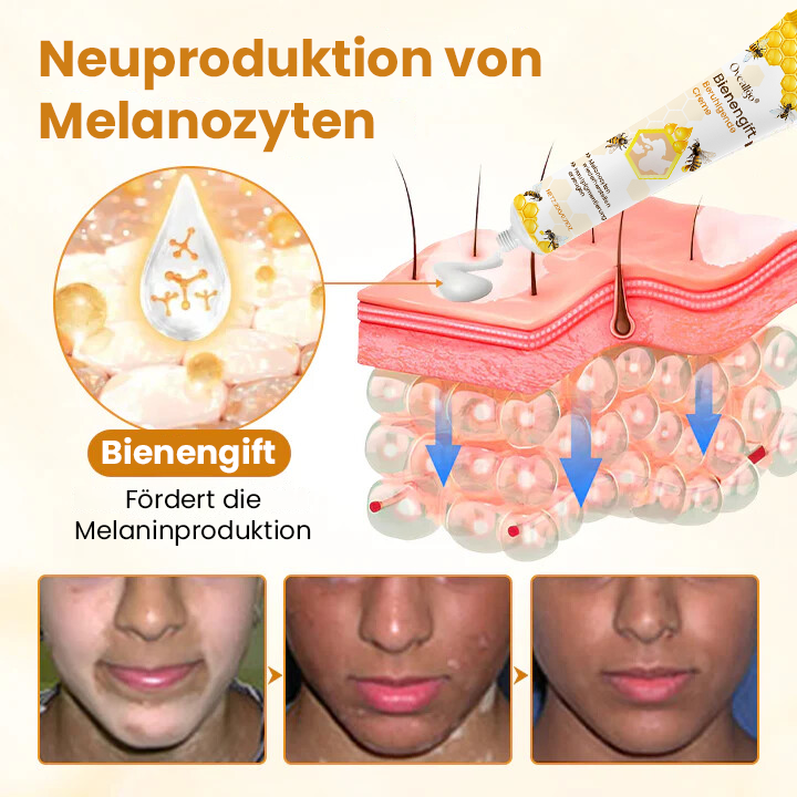 Oveallgo® Bienengift-Beruhigungscreme