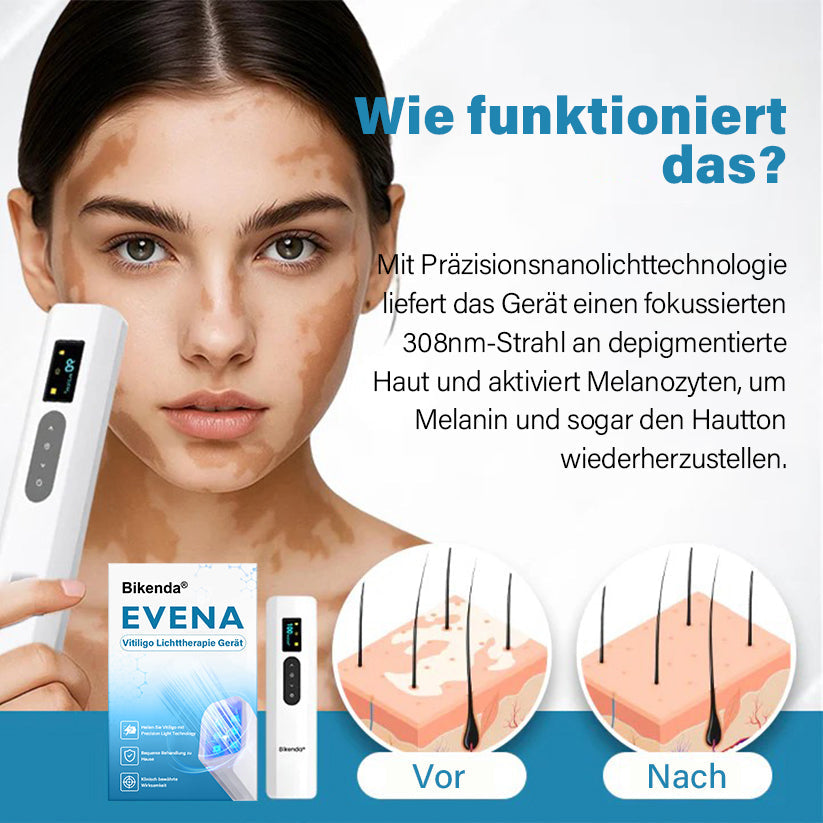 Bikenda® EVENA Vitiligo Lichttherapie Gerät