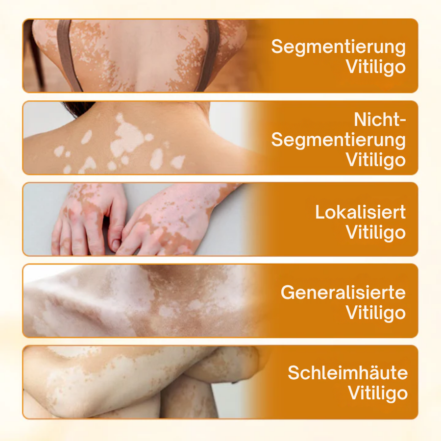 Oveallgo® Bienengift-Beruhigungscreme
