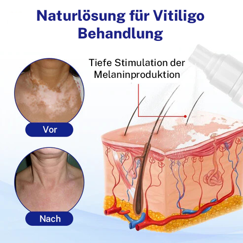 Oveallgo® Evenora Kräuterspray (Copy)