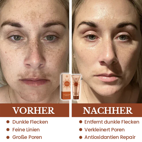 Fivfivgo® Herbal Spots Peel-Off-Gesichtsmaske