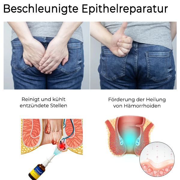 Cvreoz® Pflanzliche Hämorrhoiden Behandlung Anal Spray PRO