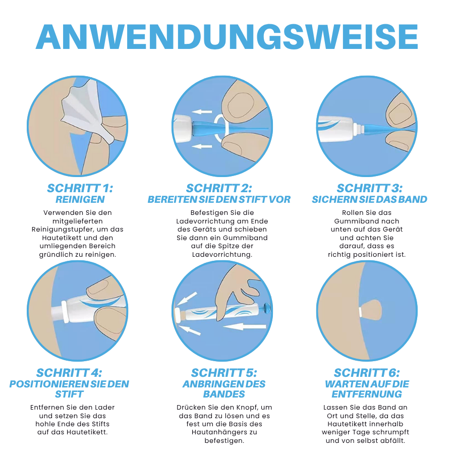 Fivfivgo® Schmerzfreier Stift zur Entfernung von Hautmarkierungen zu Hause Pro