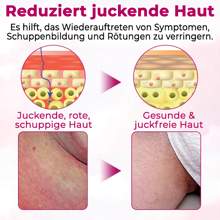 Fivfivgo® Frauen GentY Relief Creme
