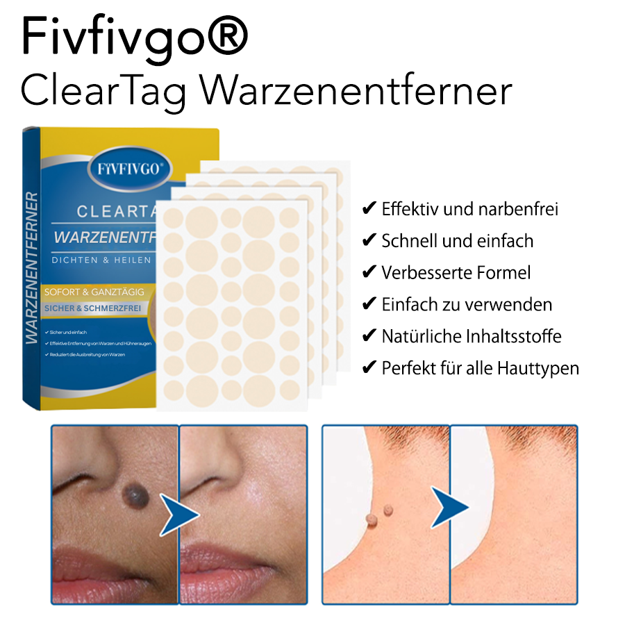 Fivfivgo® ClearTag Warzenentferner: Pflaster versiegeln & heilen