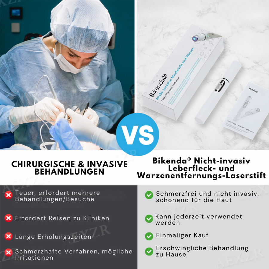 Bikenda® Nicht-invasiv Leberfleck- und Warzenentfernungs-Laserstift Exklusiv