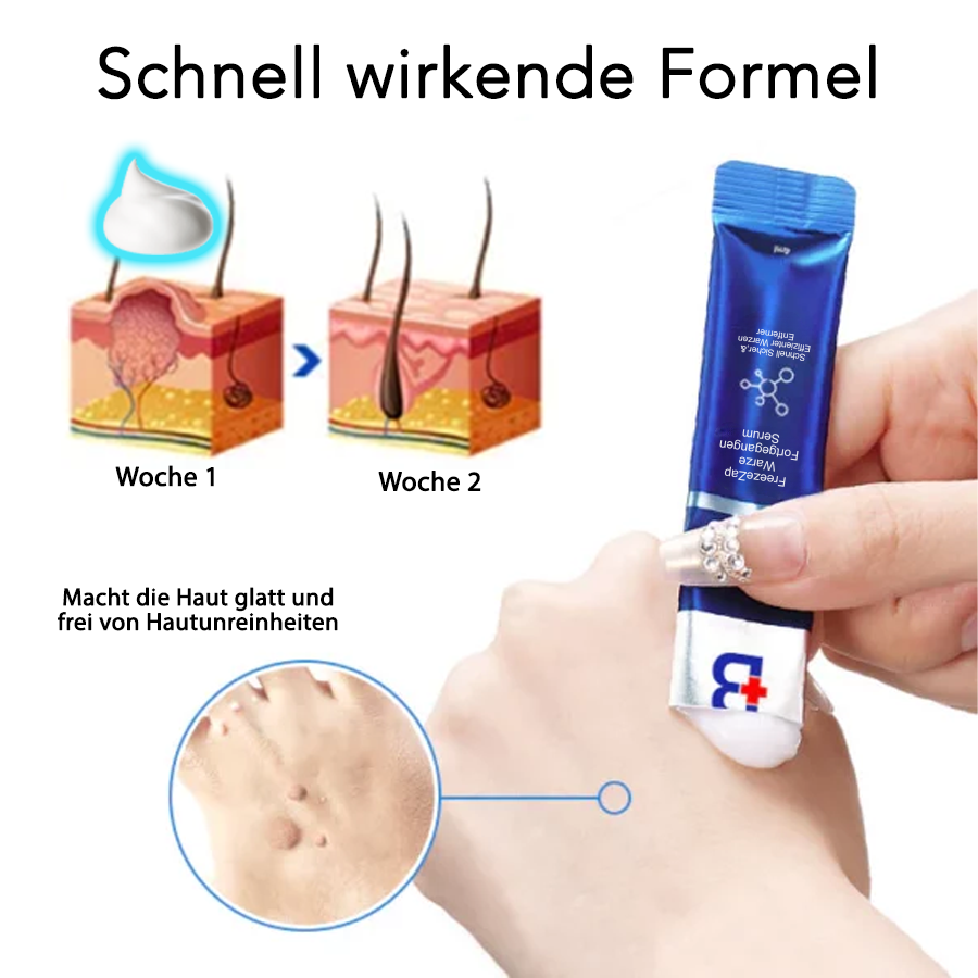 Fivfivgo® Freeze Zap Warze Fortgegangen Serum