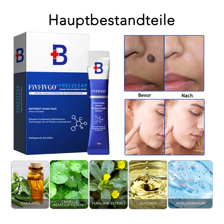 Fivfivgo® Freeze Zap Warze Fortgegangen Serum