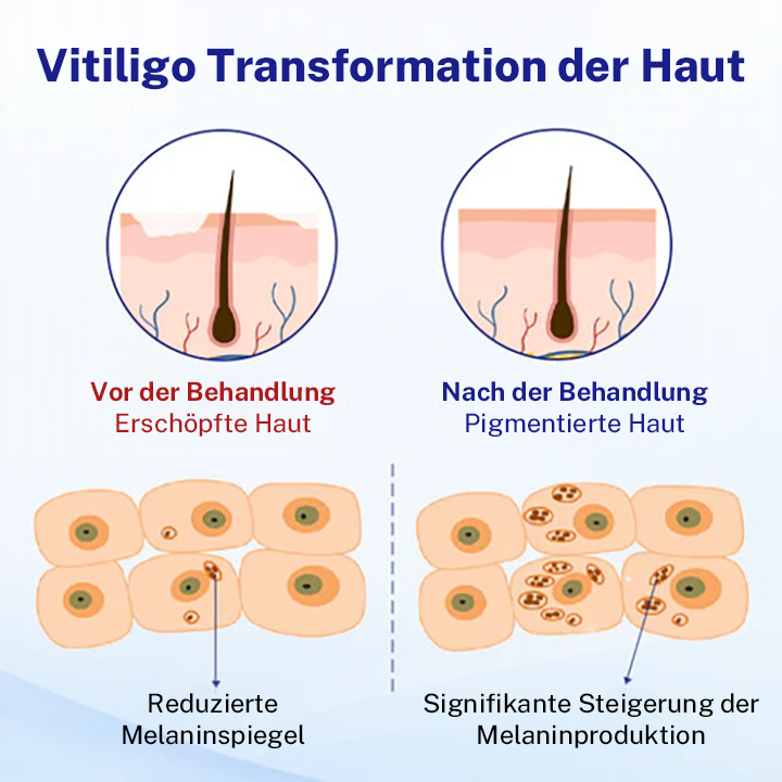 Oveallgo® Evenora Kräuterspray (Copy)