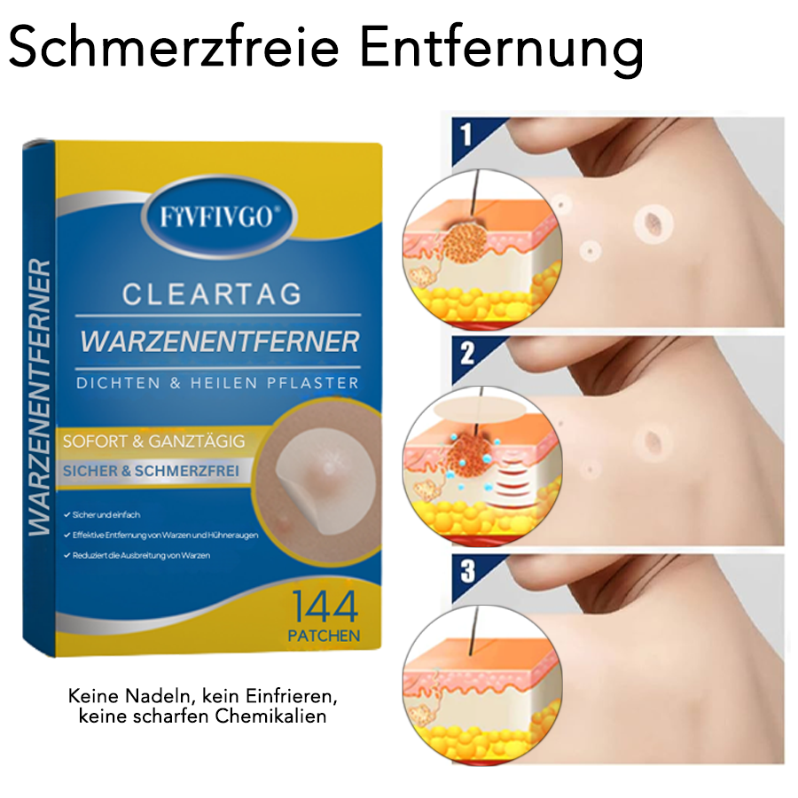 Fivfivgo® ClearTag Warzenentferner: Pflaster versiegeln & heilen