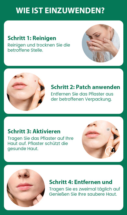 ✅Official Store: Oveallgo® Magnesium MicroPin Target & Clear Patch zur Entfernung von Warzen