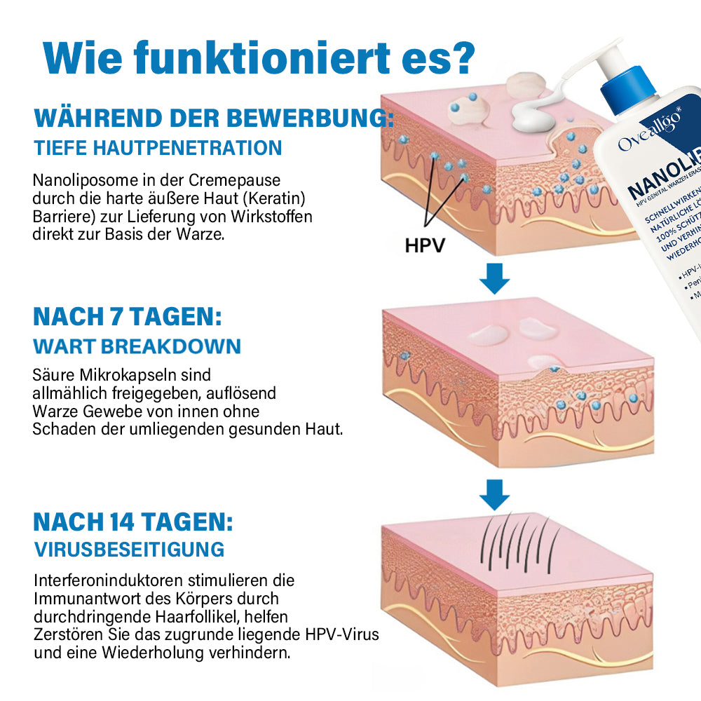 Oveallgo® NanoLipo HPV Genital warzen-Eraser creme Promax