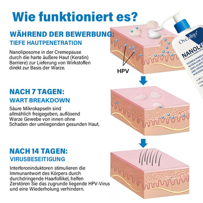 Oveallgo® NanoLipo HPV Genital warzen-Eraser creme Promax