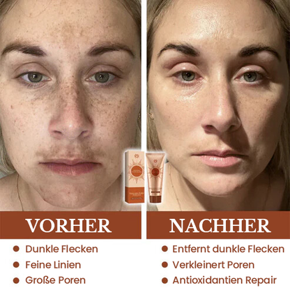 Fivfivgo® Herbal Spots Peel-Off-Gesichtsmaske