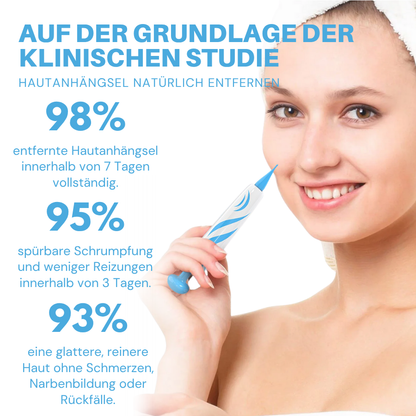 Fivfivgo® Schmerzfreier Stift zur Entfernung von Hautmarkierungen zu Hause Pro