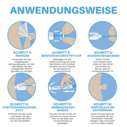 Fivfivgo® Schmerzfreier Stift zur Entfernung von Hautmarkierungen zu Hause Pro