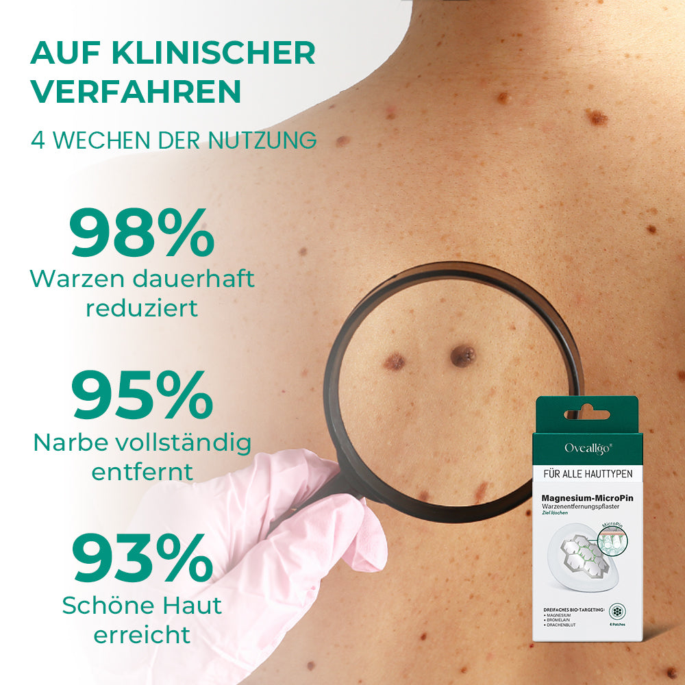 ✅Official Store: Oveallgo® Magnesium MicroPin Target & Clear Patch zur Entfernung von Warzen