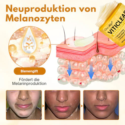 Oveallgo® VitiClear Prox Bienengift Creme