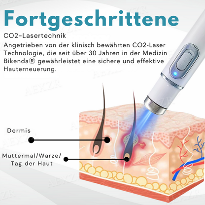 Bikenda® Nicht-invasiv Leberfleck- und Warzenentfernungs-Laserstift Turbo