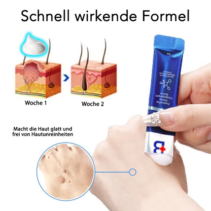 Fivfivgo® Freeze Zap Warze Fortgegangen Serum